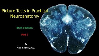 Picture Test in Neuroanatomy Brain Sections 1 [upl. by Henrion]