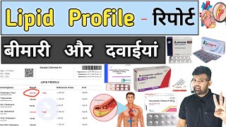 Why is Lipid Profile Test Important  Dr Kirti Chadha [upl. by Audrey]