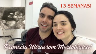 Ultrassom Morfológica do primeiro trimestre 13 Semanas de Gravidez  Muita emoção 05122023 ❤️ [upl. by Krenn]