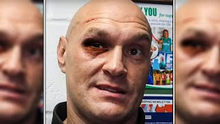 Tyson Fury TEARS UP On Live After John Fury FIRES [upl. by Dannon416]