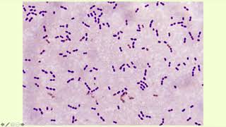 AlphaHemolytic Streptococci  Microbiology Boot Camp [upl. by Washko525]