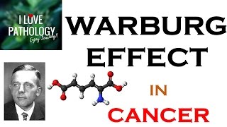 NEOPLASIA 6 WARBURG EFFECT Hallmark of CANCER What Why amp How [upl. by Merilee]