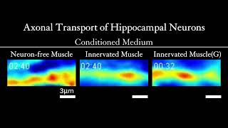 Axonal Transport of Hippocampal Neurons [upl. by Armelda409]