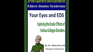 Your Eyes and EDS  by Dr Diana Driscoll [upl. by Regdirb764]