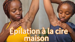 Zero boutons zero poils incarnés avec ma methode dépilation Maison🥰🥰Mon rêve Africain [upl. by Hymen]