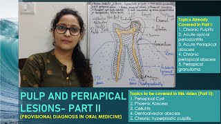 Pulp and Periapical Infections Part II in Hindil Chairside Diagnosis [upl. by Atilehs]