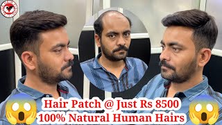 hair patch in bangalore hair fixing for men non surgical hair replacement hair fixing video [upl. by Yursa687]