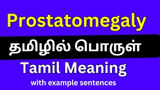 Prostatomegaly meaning in TamilProstatomegaly தமிழில் பொருள் [upl. by Daahsar]