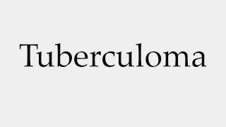 How to Pronounce Tuberculoma [upl. by Bijan942]