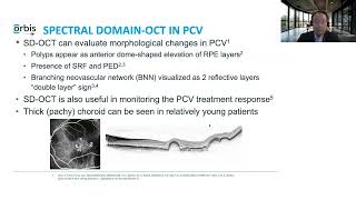 Lecture Polypoidal Choroidal Vasculopathy and Retinal Complications of Myopia [upl. by Diet]