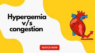 Hyperaemia vs congestion  pathology  MBBS [upl. by Annoel]