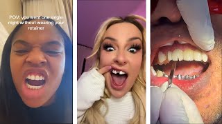 Tiktok Teeth Trends Gone WRONG [upl. by Einotna]