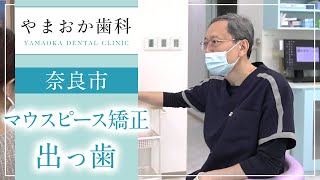 奈良市で出っ歯を治すならマウスピース矯正がおすすめ！やまおか歯科・矯正歯科 [upl. by Reinhardt]