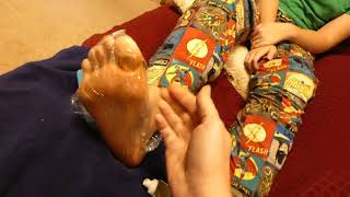 Curing Athletes Foot Fast  Iodine Antifungal Cream and Saran Wrap [upl. by Mosenthal]