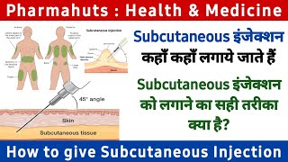 How to give Subcutaneous injection  SC injection  Types of Injection  Insulin injection  B12 inj [upl. by Dianthe]