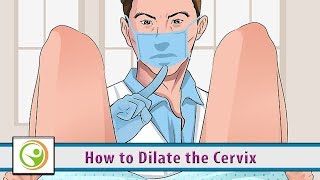 How to Dilate the Cervix [upl. by Ecinrahs]