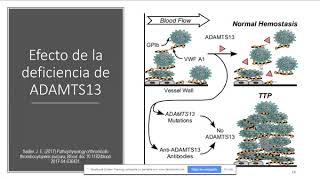 Charla Magistral Microangiopatía Trombótica [upl. by Gayn]