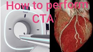 HOW TO PERFORM Cardiac Angiography [upl. by Kattie]