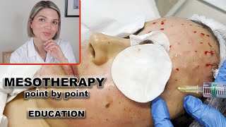 Mesotherapy for face full demo and point by point injection technique [upl. by Welcy]