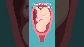 How the Cervix Changes in Labor laboranddelivery [upl. by Fogg]