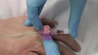 Cannulation How to insert a cannula One Minute Edition Medicine in a Nutshell IV Access [upl. by Vaughn662]