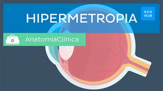 Hipermetropia Definição causas sintomas diagnóstico e tratamento  Kenhub [upl. by Petrie]