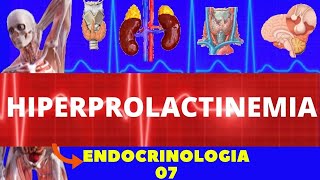 HIPERPROLACTINEMIA AUMENTO DE PROLACTINA  ENDOCRINOLOGIA [upl. by Aynotan716]