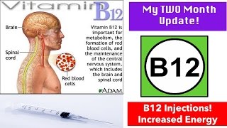 My B12 Injection Experience Two Months in [upl. by Aivatnohs]