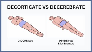 Decorticate vs Decerebrate Explained [upl. by Vena]