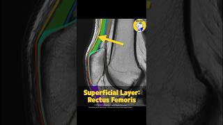 Fig 4B01 Anatomy of the Multilayered Quadriceps Tendon Part 1 [upl. by Alvina273]