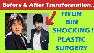 Hyun Bin Plastic Surgery Before and After Full HD [upl. by Sarazen321]