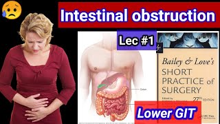 Lower GIT Surgery LECTURE 1 intestinal obstruction 🌹 dyanmic adynamic obstruction constipation [upl. by Akener646]