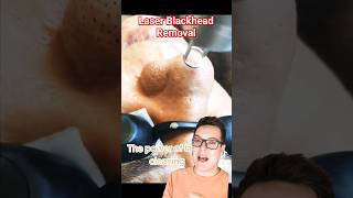 😱 CRAZY LASER BLACKHEAD REMOVAL  This Cant Be Real shorts [upl. by Franchot680]