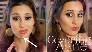 How to Cover a Pimple FLAWLESSLY [upl. by Alik]