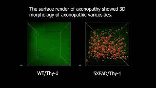 Axonopathic varicosities Analysis using Binaree Tissue clearing kit [upl. by Ominorej]