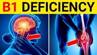 9 Signs and Symptoms of Thiamine Vitamin B1 Deficiency  Thiamine Deficiency Symptoms [upl. by Notaes]