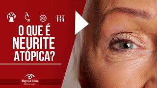 O que é a Neurite Óptica  Dr Marcos de Castro Oftalmologia [upl. by Yoshiko893]