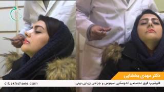 Taping Nose after Rhinoplasty by Dr Mehdi Bakhshaee drbakhshaeecom [upl. by Lev269]