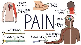 Understanding The Causes of Pain and Pain Management [upl. by Eul262]