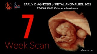 7 Week Scan in Fetal Medicine Early Fetal Scan Conference 2022 [upl. by Jodee]