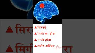 Brain Tumor Cancer Awareness Month Signamp Symptoms  Dr Amit Pandey  Apollo Hospital Lucknow [upl. by Sahpec310]