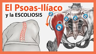 🔴 Psoas Ilíaco y la Escoliosis 👉 EJERCICIOS para la Pelvis y la Columna Lumbar [upl. by Naujet]