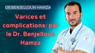 Varices et complications par le Dr Benjelloun Hamza [upl. by Garrison]