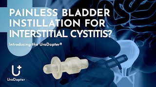 Painless Bladder Instillation for Interstitial Cystitis Introducing the UroDapter® [upl. by Eugilegna]