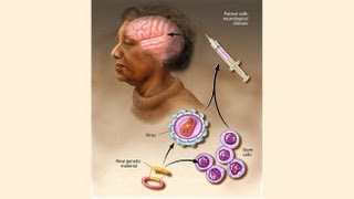 Human gene therapy types of gene therapy part 3 [upl. by Tab]