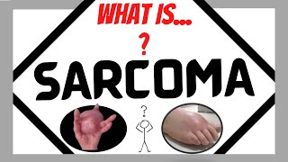 SARCOMA What is it [upl. by Drucy]