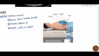 Ascites for USMLE Step 2 [upl. by Auof321]