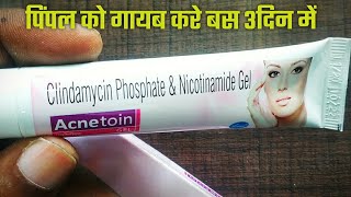 Acnetoin gel  Acnetoin  acnetoin gel uses in hindi  Clindamycin phosphate gel acnetoin gel price [upl. by Rentsch686]