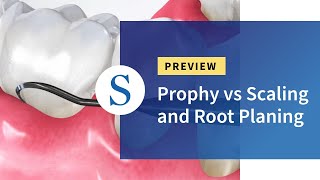 Prophy vs Scaling and Root Planing [upl. by Redneval]