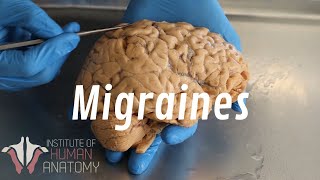 What Are Migraines [upl. by Nnad]